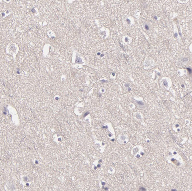 EGF-L6 Antibody - BSA Free Immunohistochemistry-Paraffin: EGF-L6 Antibody [NBP2-33282]