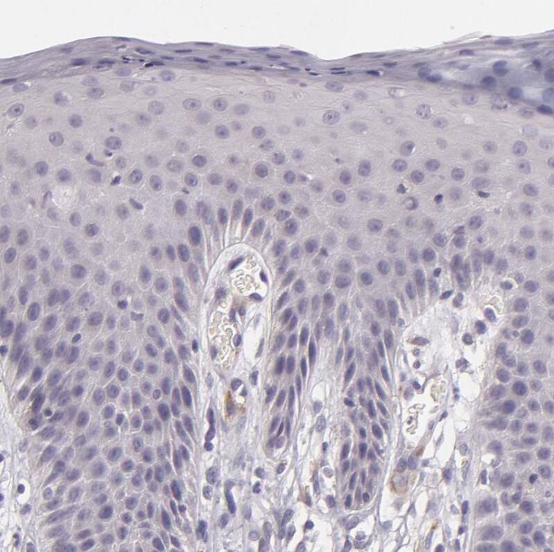 EGF-L6 Antibody - BSA Free Immunohistochemistry-Paraffin: EGF-L6 Antibody [NBP2-33282]