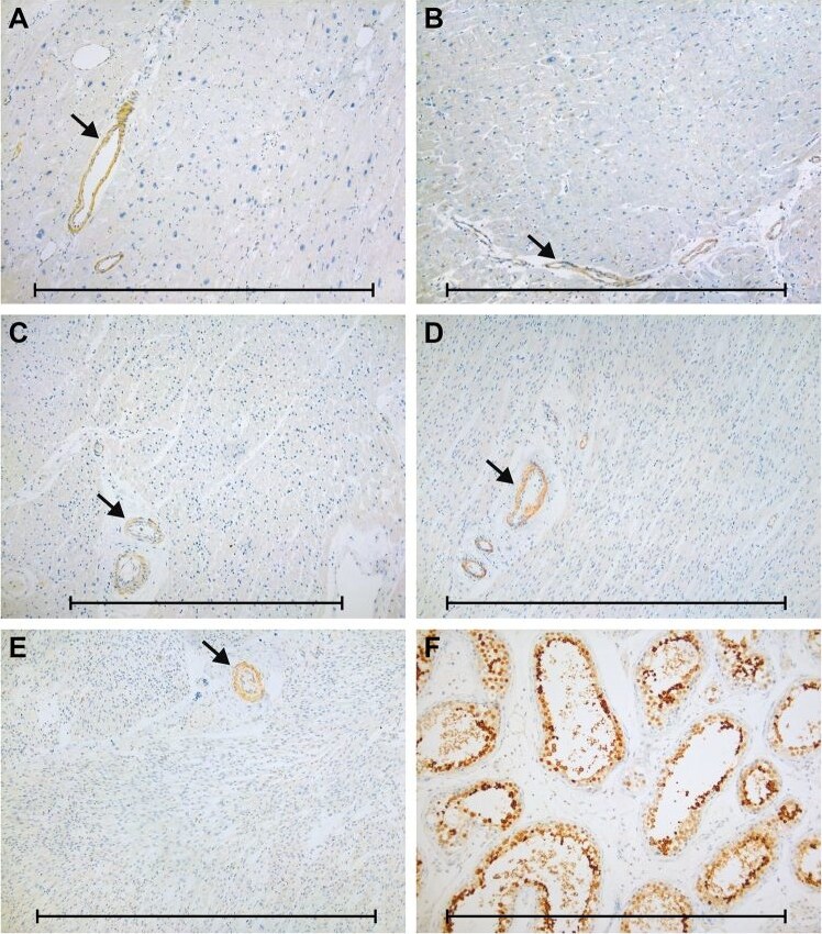 Calreticulin-2/CALR3 Antibody
