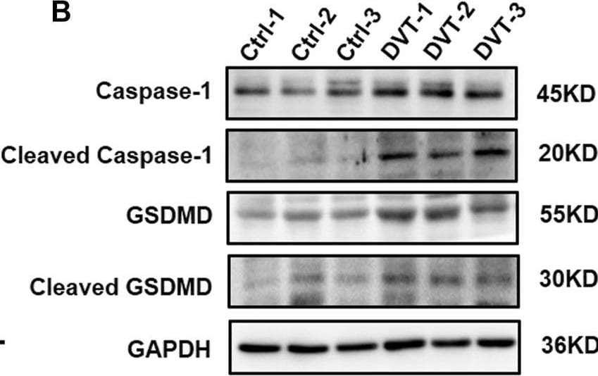 GSDMDC1 Antibody