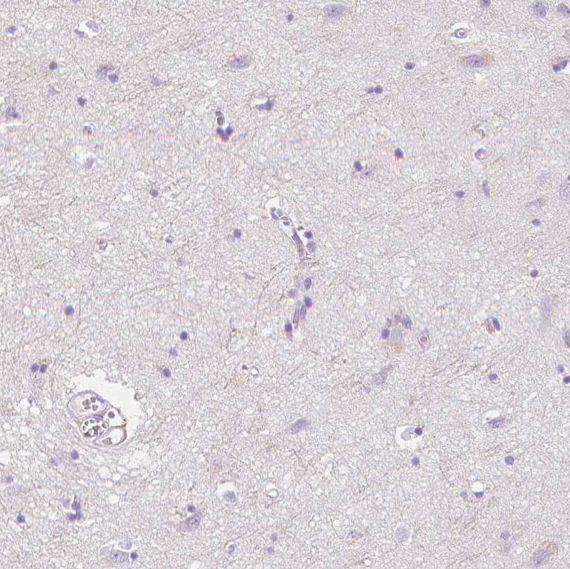 MMR/CD206/Mannose Receptor Antibody Immunohistochemistry: MMR/CD206/Mannose Receptor Antibody [MMR/CD206/Mannose Receptor Antibody]
