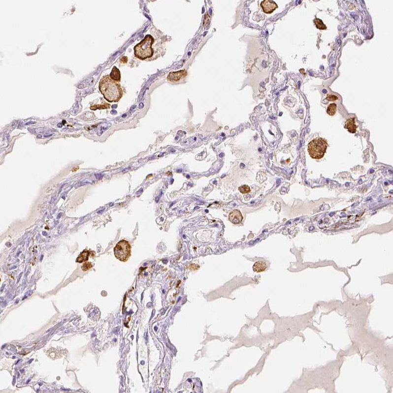 MMR/CD206/Mannose Receptor Antibody Immunohistochemistry: MMR/CD206/Mannose Receptor Antibody [MMR/CD206/Mannose Receptor Antibody]