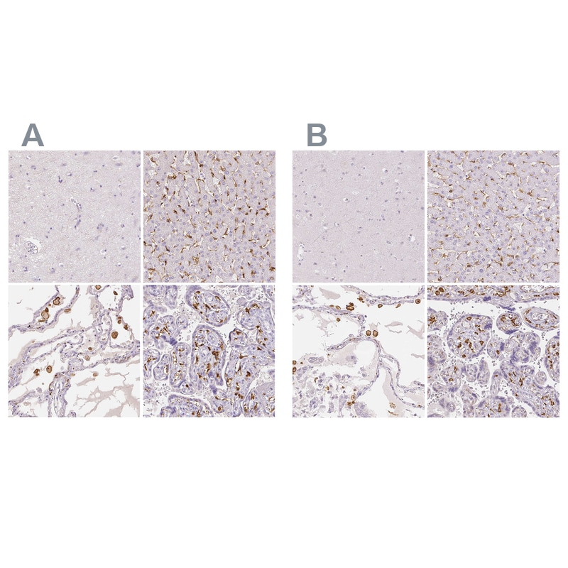 MMR/CD206/Mannose Receptor Antibody Immunohistochemistry: MMR/CD206/Mannose Receptor Antibody [MMR/CD206/Mannose Receptor Antibody]