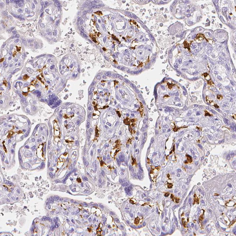 MMR/CD206/Mannose Receptor Antibody Immunohistochemistry: MMR/CD206/Mannose Receptor Antibody [MMR/CD206/Mannose Receptor Antibody]