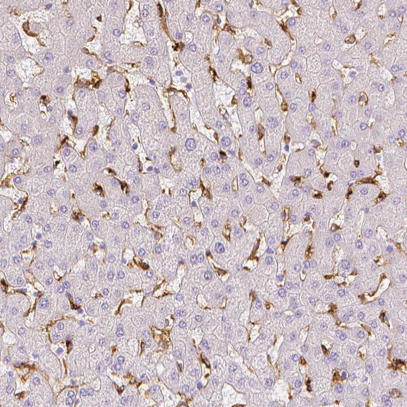 MMR/CD206/Mannose Receptor Antibody Immunohistochemistry: MMR/CD206/Mannose Receptor Antibody [MMR/CD206/Mannose Receptor Antibody]