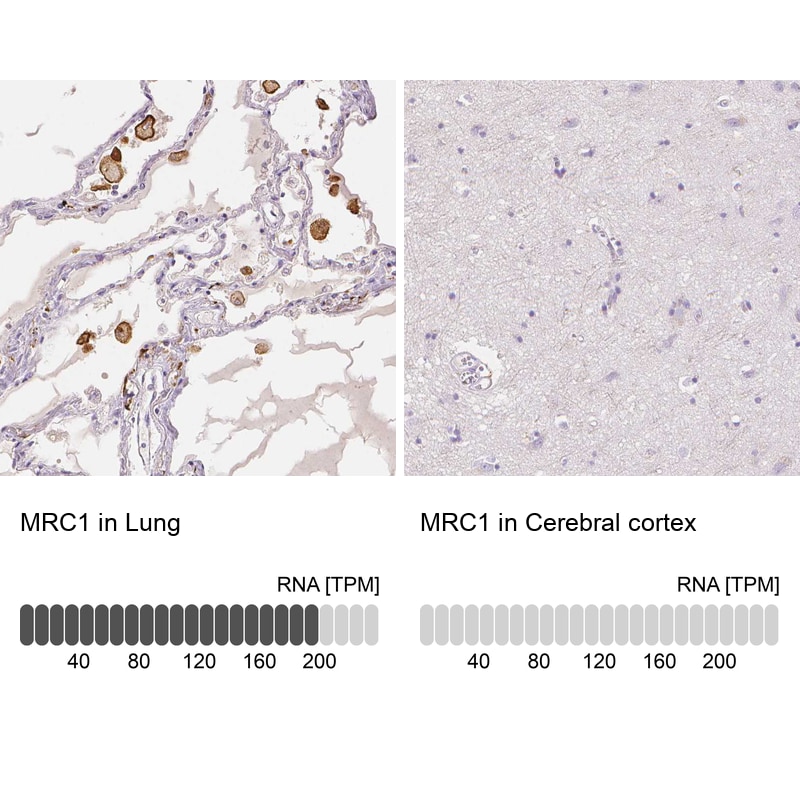 MMR/CD206/Mannose Receptor Antibody Immunohistochemistry: MMR/CD206/Mannose Receptor Antibody [MMR/CD206/Mannose Receptor Antibody]