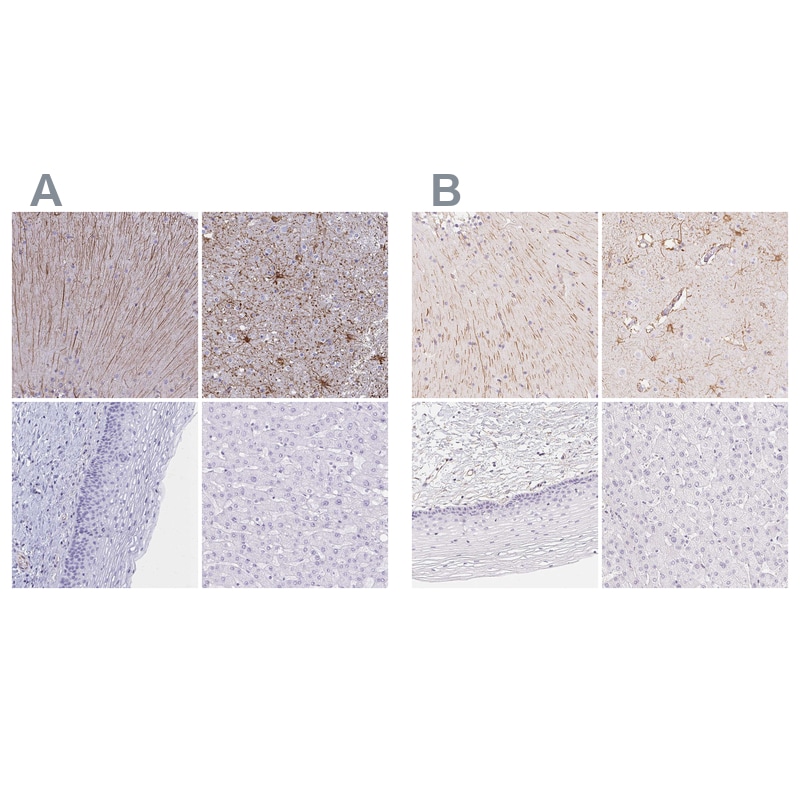 GFAP Antibody Immunohistochemistry-Paraffin: GFAP Antibody Antibody [NBP2-33774]