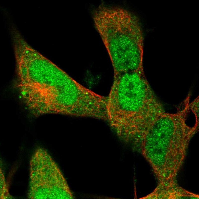 Retinol Binding Protein RBP Antibody - BSA Free Immunocytochemistry/ Immunofluorescence: Retinol Binding Protein RBP Antibody [NBP2-33862]