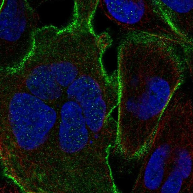Ankyrin Brain Antibody - BSA Free Immunocytochemistry/ Immunofluorescence: Ankyrin Brain Antibody [NBP2-33863]