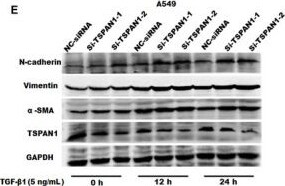 TSPAN1 Antibody
