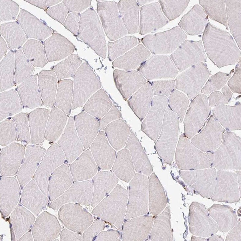 P4HA2 Antibody - BSA Free Immunohistochemistry-Paraffin: P4HA2 Antibody [NBP2-33878]