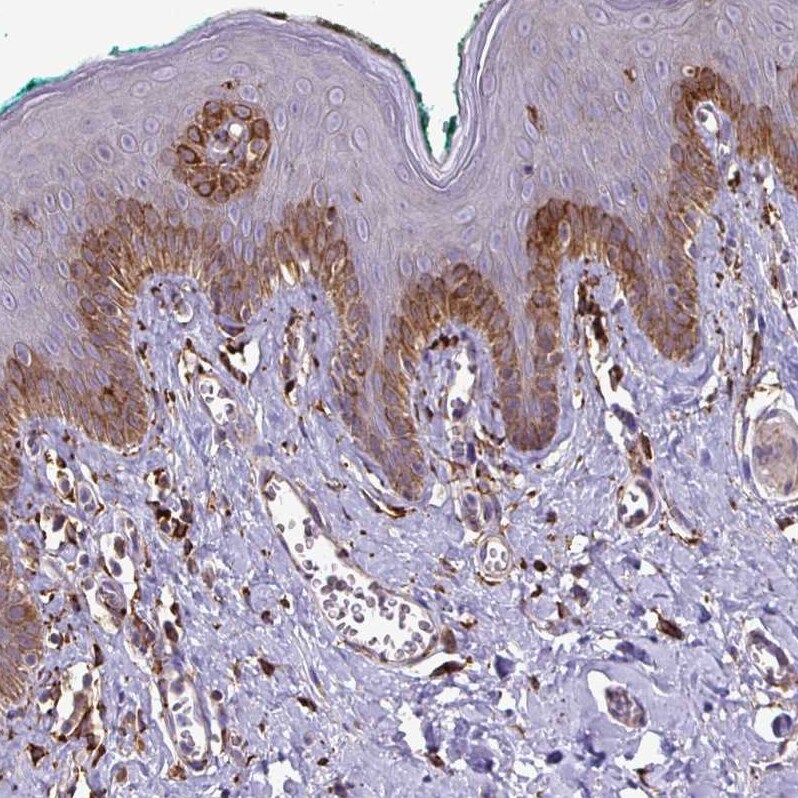 P4HA2 Antibody - BSA Free Immunohistochemistry-Paraffin: P4HA2 Antibody [NBP2-33878]