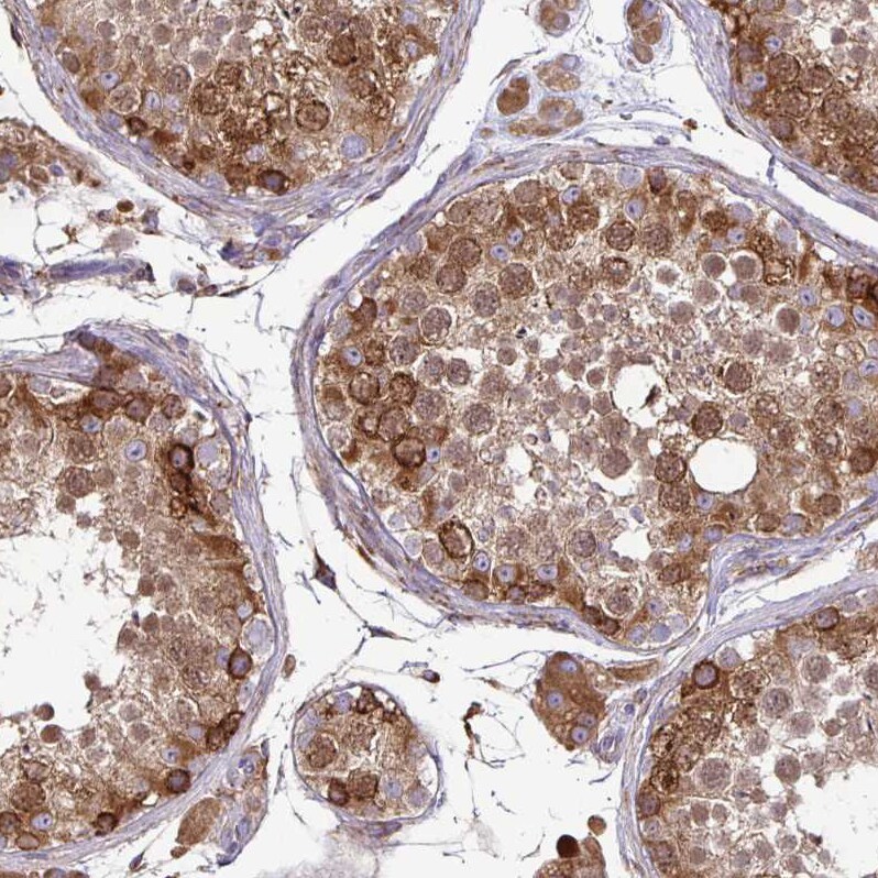 P4HA2 Antibody - BSA Free Immunohistochemistry-Paraffin: P4HA2 Antibody [NBP2-33878]
