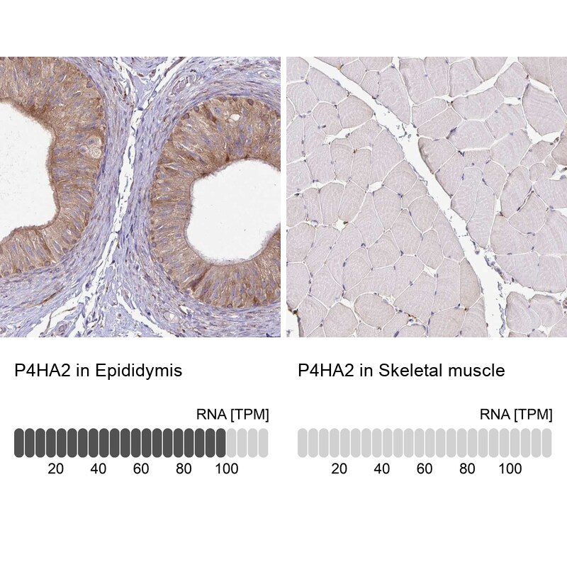 P4HA2 Antibody - BSA Free Immunohistochemistry-Paraffin: P4HA2 Antibody [NBP2-33878]