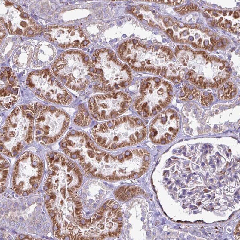 P4HA2 Antibody - BSA Free Immunohistochemistry-Paraffin: P4HA2 Antibody [NBP2-33878]