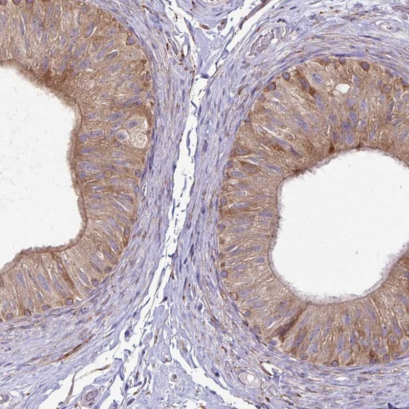 P4HA2 Antibody - BSA Free Immunohistochemistry-Paraffin: P4HA2 Antibody [NBP2-33878]