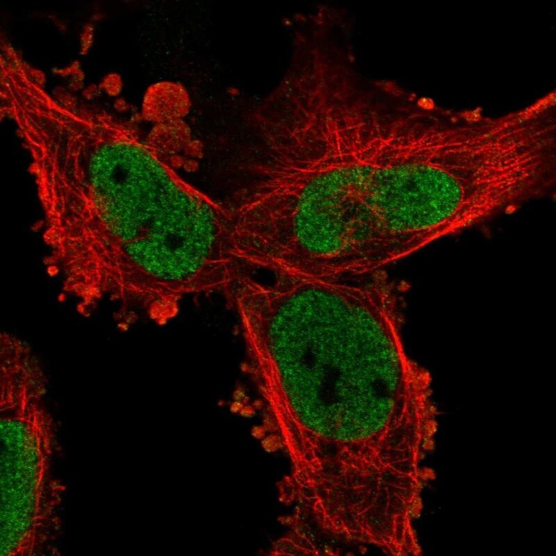 PHIP Antibody - BSA Free Immunocytochemistry/ Immunofluorescence: PHIP Antibody [NBP2-33883]