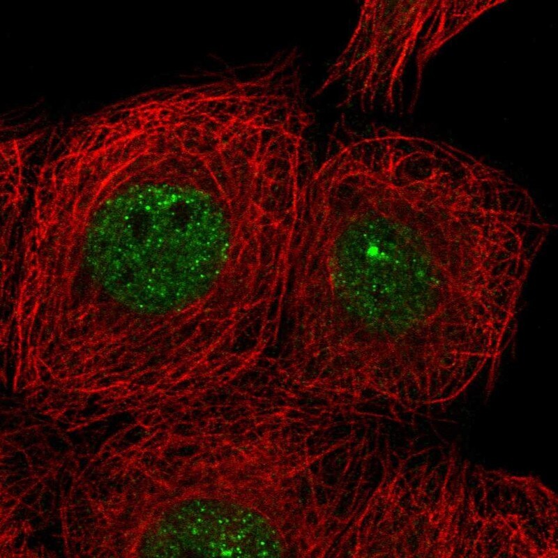 CIZ1 Antibody - BSA Free Immunocytochemistry/ Immunofluorescence: CIZ1 Antibody [NBP2-33890]