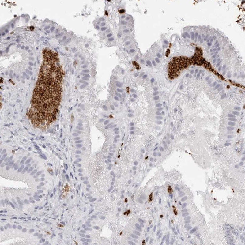 Spectrin alpha 1 Antibody - BSA Free Immunohistochemistry: Spectrin alpha 1 Antibody - BSA Free [NBP2-33911]