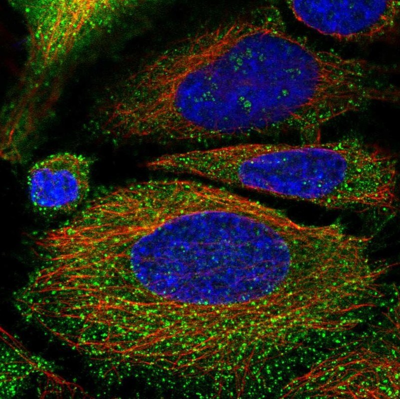 DAB2 Antibody - BSA Free Immunocytochemistry/ Immunofluorescence: DAB2 Antibody [NBP2-33915]