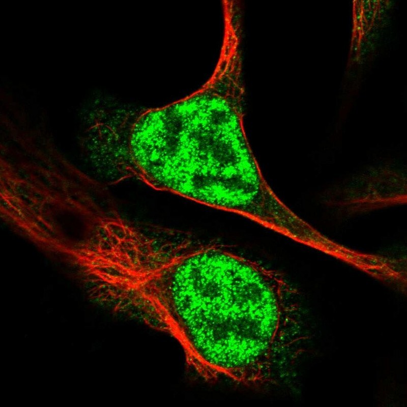 RAD54L Antibody - BSA Free Immunocytochemistry/ Immunofluorescence: RAD54L Antibody [NBP2-33916]