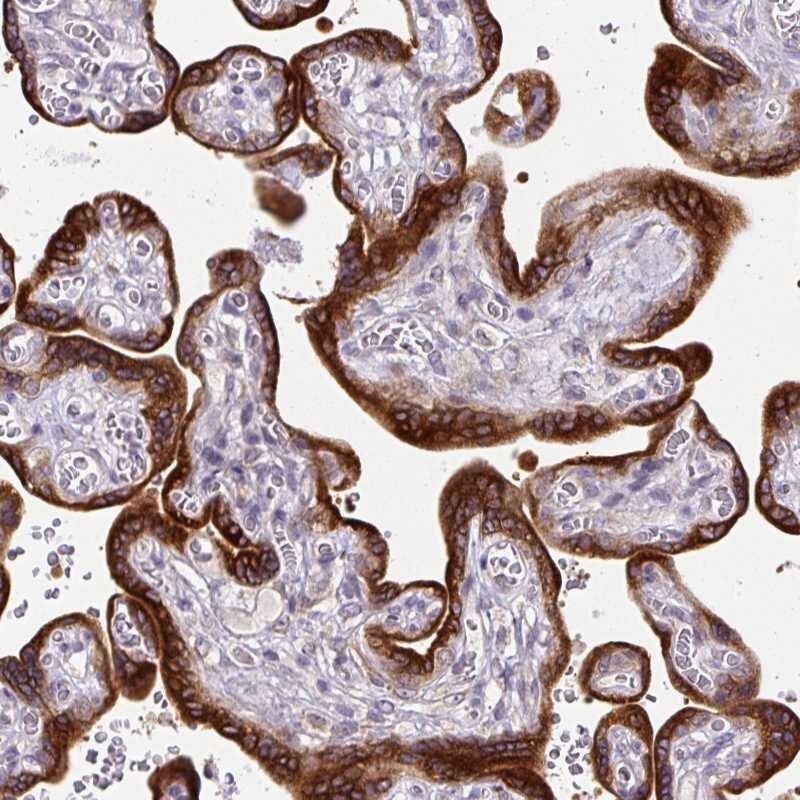 AMFR/gp78 Antibody - BSA Free Immunohistochemistry: AMFR/gp78 Antibody - BSA Free [NBP2-33917]