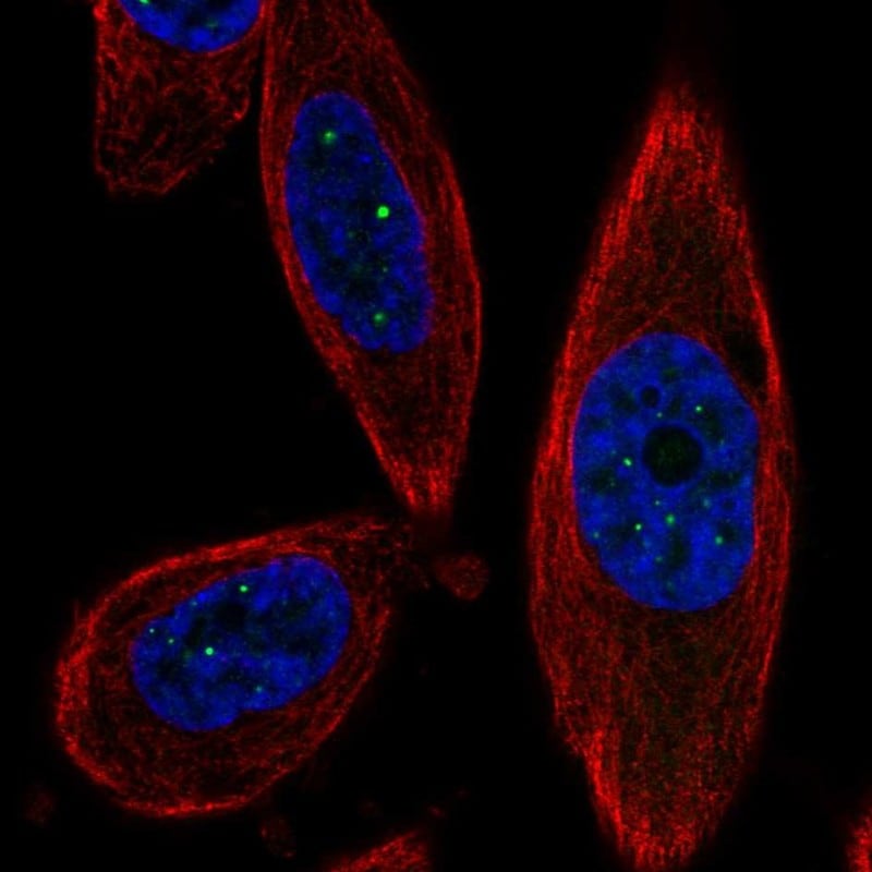 SSTK-IP Antibody - BSA Free Immunocytochemistry/ Immunofluorescence: SSTK-IP Antibody [NBP2-33923]