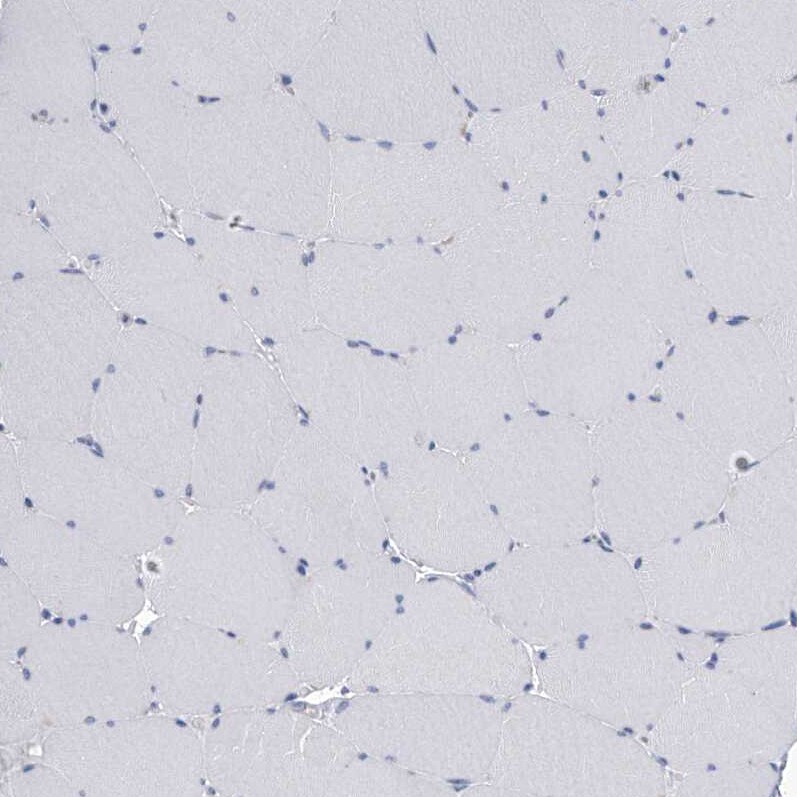 SerpinB9 Antibody - BSA Free Immunohistochemistry-Paraffin: SerpinB9 Antibody [NBP2-33924]