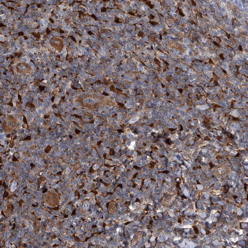 SerpinB9 Antibody - BSA Free Immunohistochemistry-Paraffin: SerpinB9 Antibody [NBP2-33924]