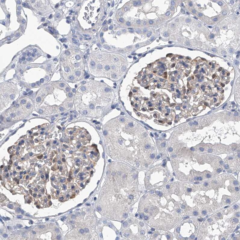SerpinB9 Antibody - BSA Free Immunohistochemistry-Paraffin: SerpinB9 Antibody [NBP2-33924]