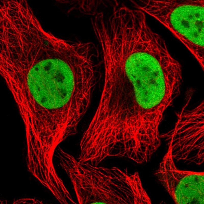 NASP Antibody - BSA Free Immunocytochemistry/ Immunofluorescence: NASP Antibody [NBP2-33928]