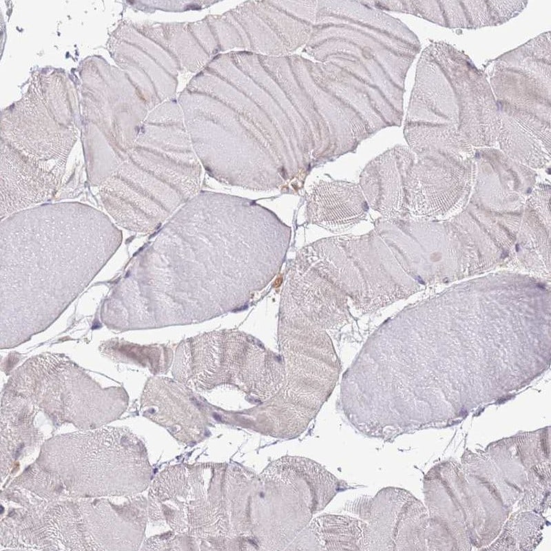 Lipin 2 Antibody - BSA Free Immunohistochemistry-Paraffin: Lipin 2 Antibody [NBP2-33931]