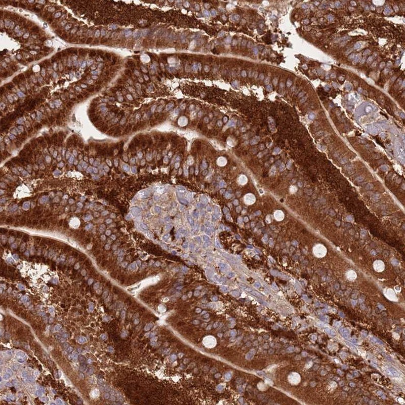 Lipin 2 Antibody - BSA Free Immunohistochemistry-Paraffin: Lipin 2 Antibody [NBP2-33931]