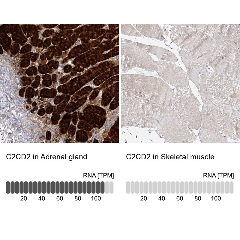 C2CD2 Antibody - BSA Free Immunohistochemistry-Paraffin: C2CD2 Antibody [NBP2-33941]