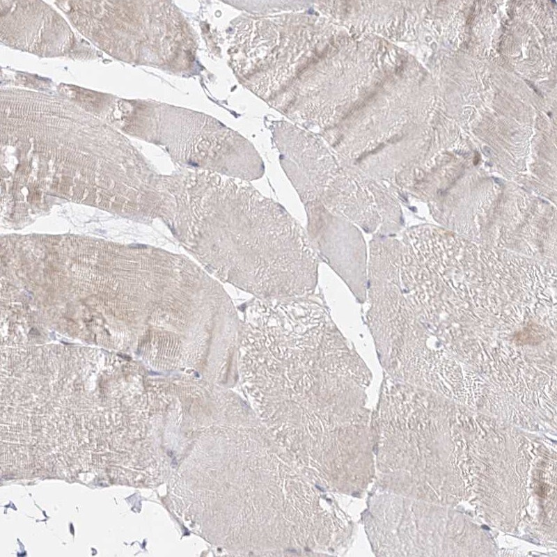 C2CD2 Antibody - BSA Free Immunohistochemistry-Paraffin: C2CD2 Antibody [NBP2-33941]