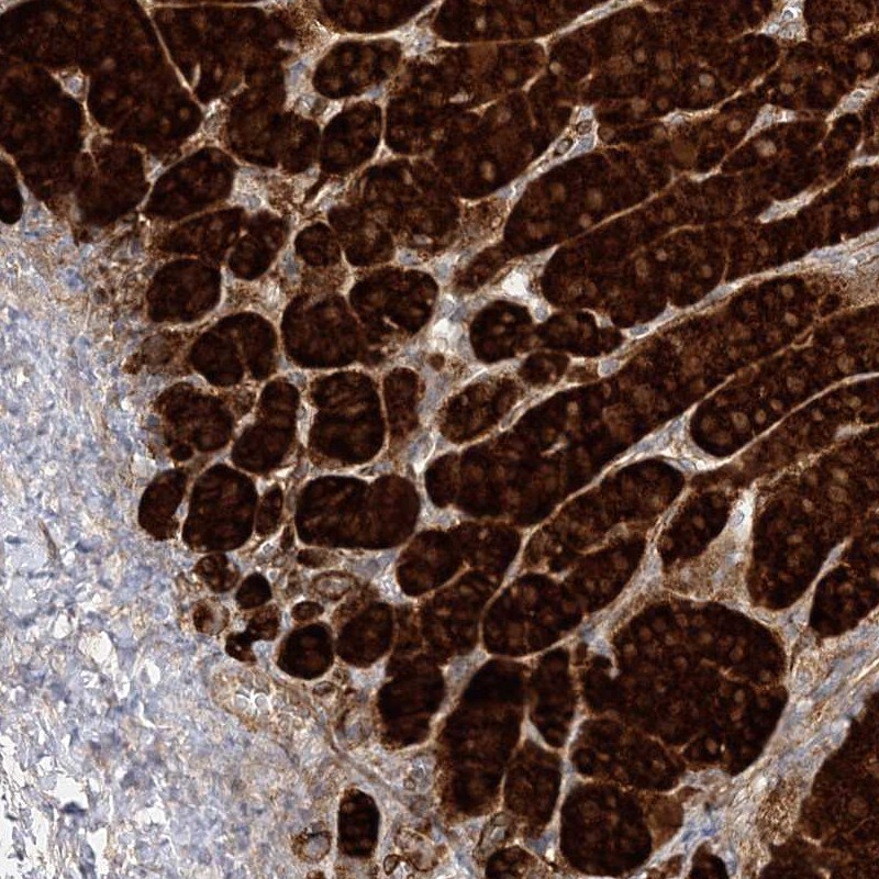 C2CD2 Antibody - BSA Free Immunohistochemistry-Paraffin: C2CD2 Antibody [NBP2-33941]