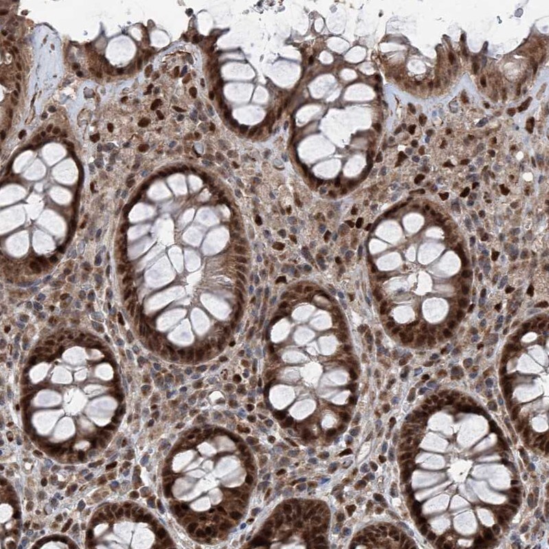 FKBP51/FKBP5 Antibody - BSA Free Immunohistochemistry-Paraffin: FKBP51/FKBP5 Antibody [NBP2-33944]