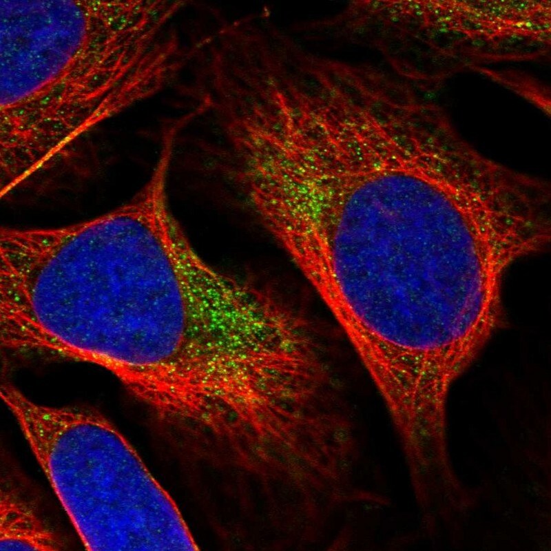 YAE1 Antibody - BSA Free Immunocytochemistry/ Immunofluorescence: YAE1 Antibody [NBP2-33945]