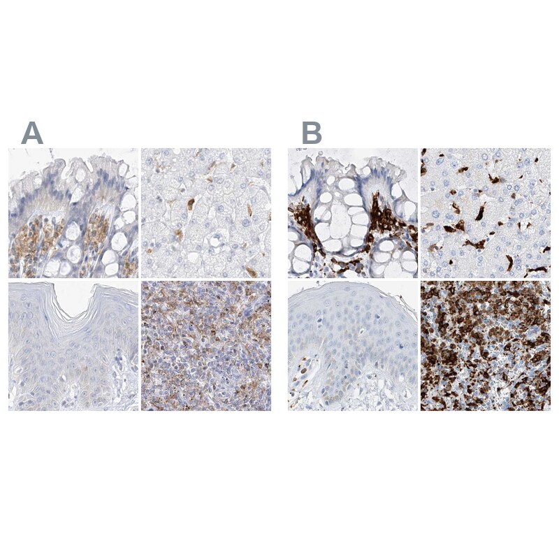 Thromboxane synthase Antibody - BSA Free Immunohistochemistry: Thromboxane synthase Antibody - BSA Free [NBP2-33947]