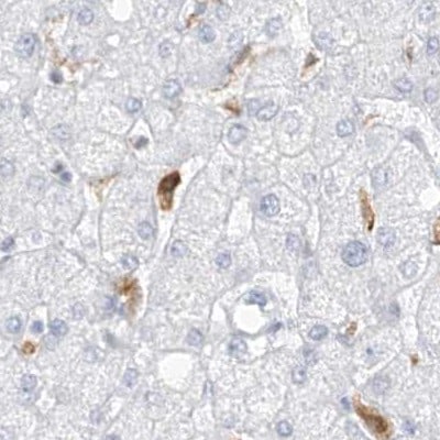 Thromboxane synthase Antibody - BSA Free Immunohistochemistry: Thromboxane synthase Antibody - BSA Free [NBP2-33947]