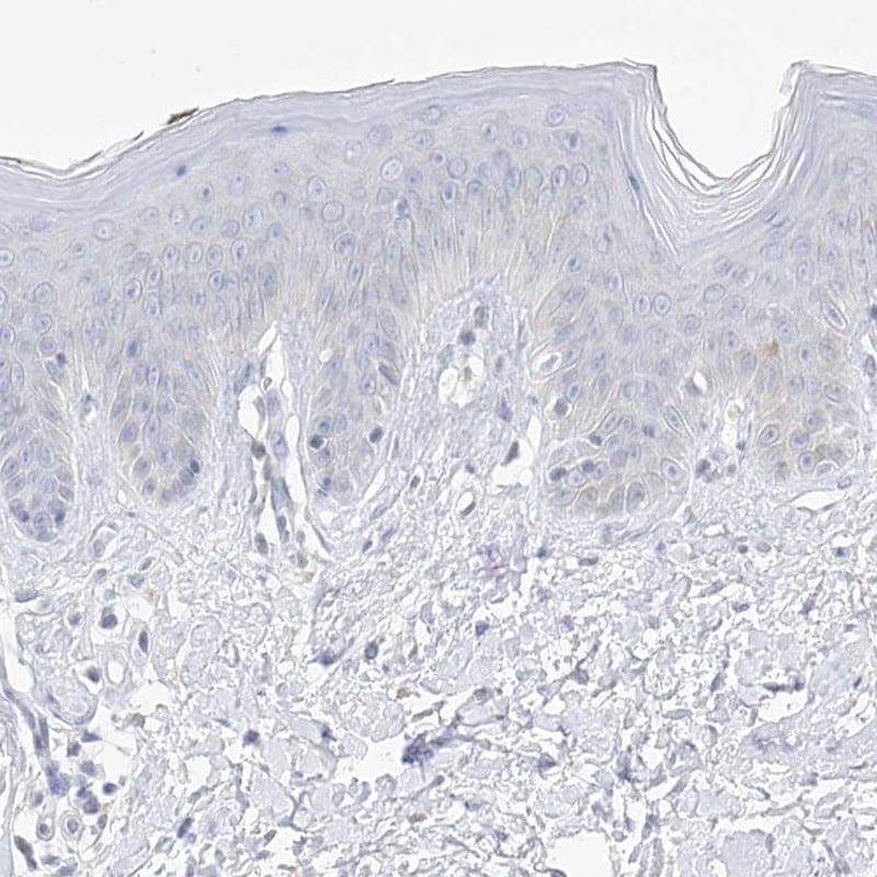 Thromboxane synthase Antibody - BSA Free Immunohistochemistry: Thromboxane synthase Antibody - BSA Free [NBP2-33947]