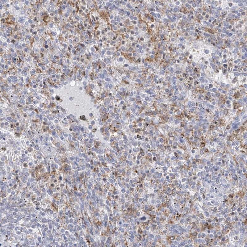 Thromboxane synthase Antibody - BSA Free Immunohistochemistry: Thromboxane synthase Antibody - BSA Free [NBP2-33947]