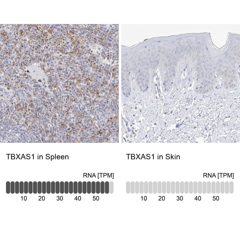 Thromboxane synthase Antibody - BSA Free Immunohistochemistry: Thromboxane synthase Antibody - BSA Free [NBP2-33947]