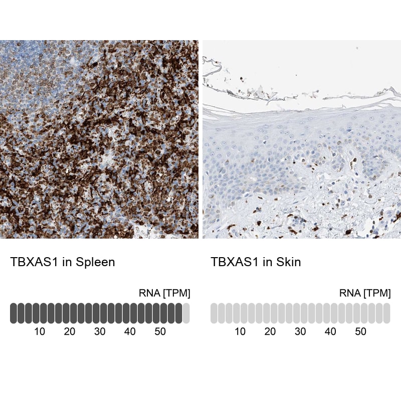 Thromboxane synthase Antibody - BSA Free Immunohistochemistry-Paraffin: Thromboxane synthase Antibody [NBP2-33948]