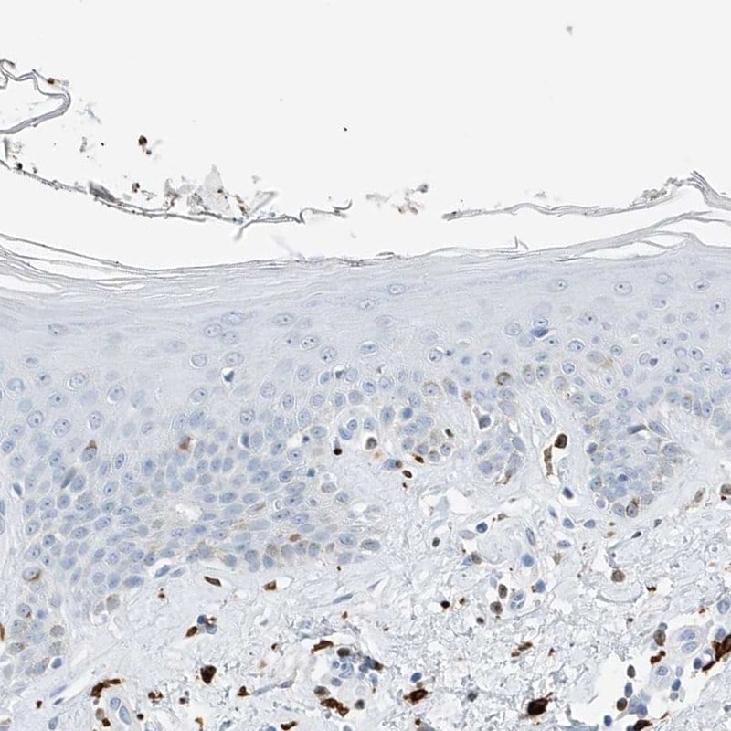 Thromboxane synthase Antibody - BSA Free Immunohistochemistry-Paraffin: Thromboxane synthase Antibody [NBP2-33948]