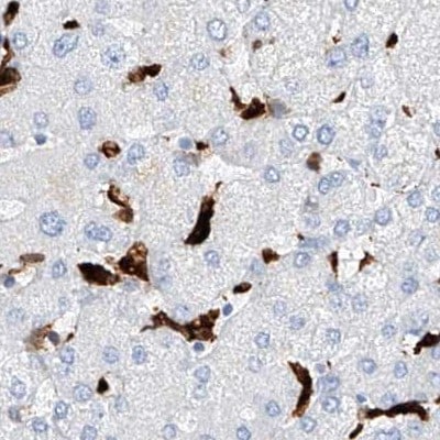 Thromboxane synthase Antibody - BSA Free Immunohistochemistry-Paraffin: Thromboxane synthase Antibody [NBP2-33948]