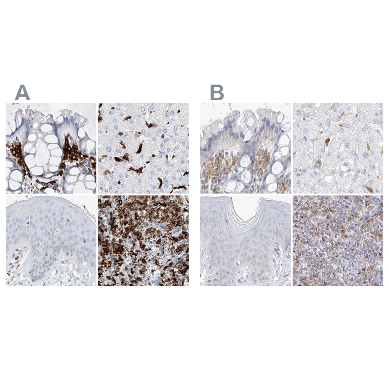 Thromboxane synthase Antibody - BSA Free Immunohistochemistry-Paraffin: Thromboxane synthase Antibody [NBP2-33948]