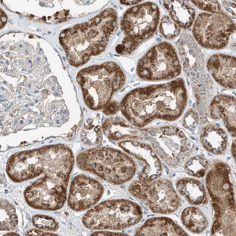 RMND1 Antibody - BSA Free Immunohistochemistry-Paraffin: RMND1 Antibody [NBP2-33951]