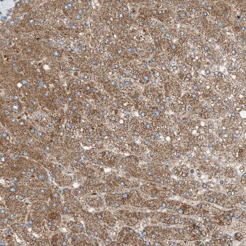 RMND1 Antibody - BSA Free Immunohistochemistry-Paraffin: RMND1 Antibody [NBP2-33951]