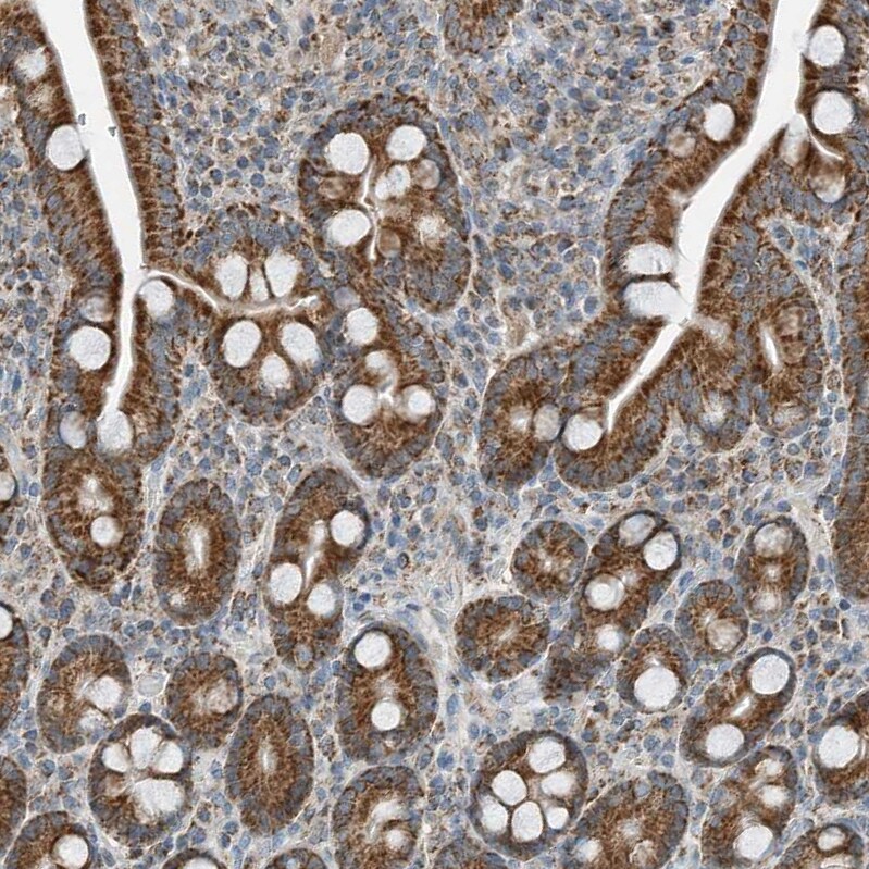RMND1 Antibody - BSA Free Immunohistochemistry-Paraffin: RMND1 Antibody [NBP2-33951]